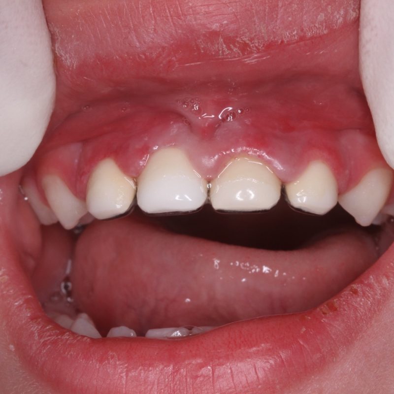 Odontopediatria depois