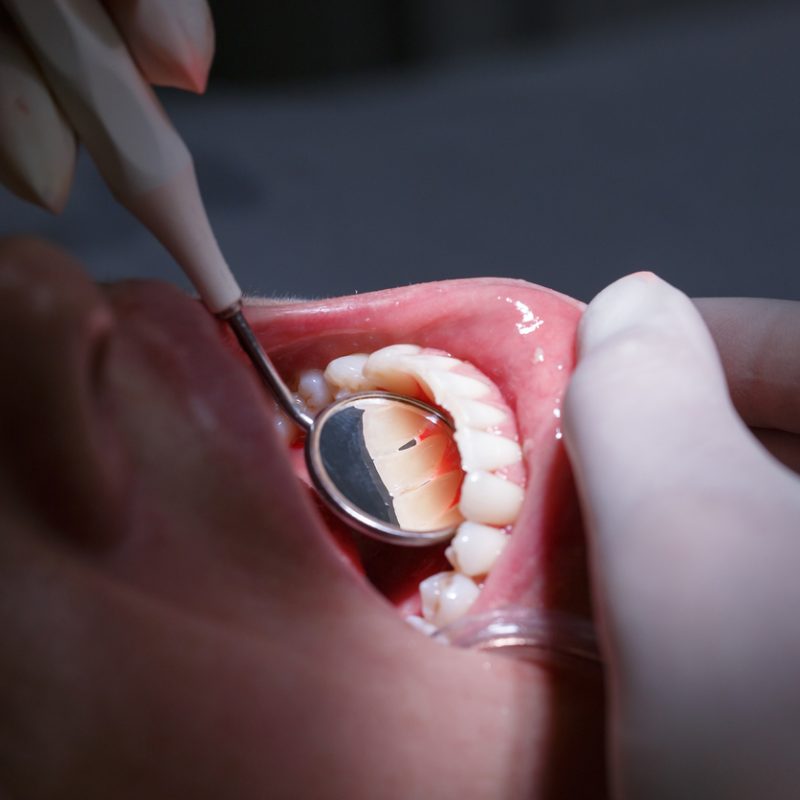 Periodontologia