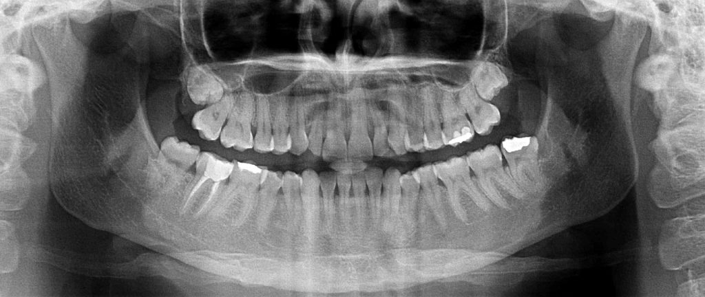 Dentes do Siso