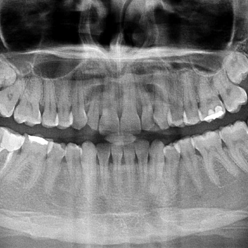 Dentes do Siso